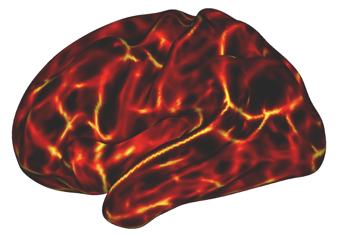 Resources — Wig Neuroimaging Lab